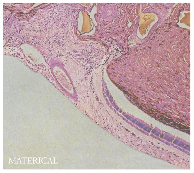 MATERICAL <br/> Materical