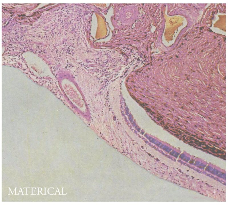 MATERICAL <br/> Materical